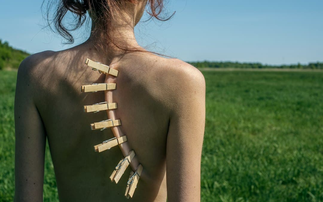 Acupuncture for Anxiety Amsterdam | Alter Physio