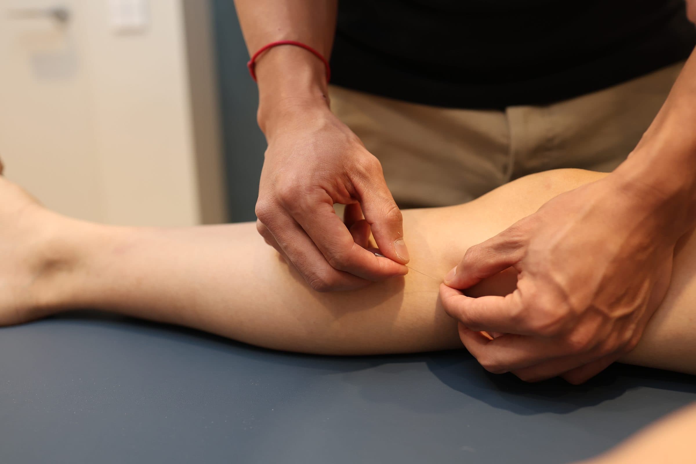Japanese acupuncture: an ultra-fine needle placed in the lower leg at Alter Physio, Amsterdam Zuid