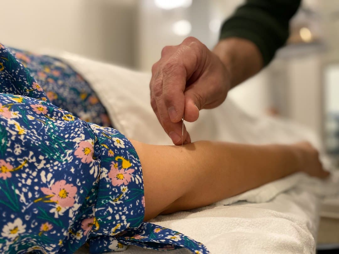 Acupunctuur bij Angst en Mentale Gezondheid in Amsterdam | Alter Physio Amsterdam