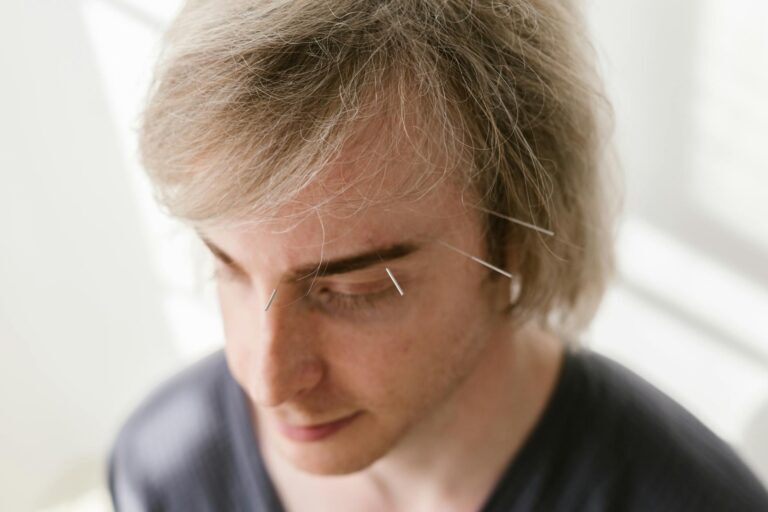 Acupuncture treatment for nasal allergies at AlterPhysio Amsterdam