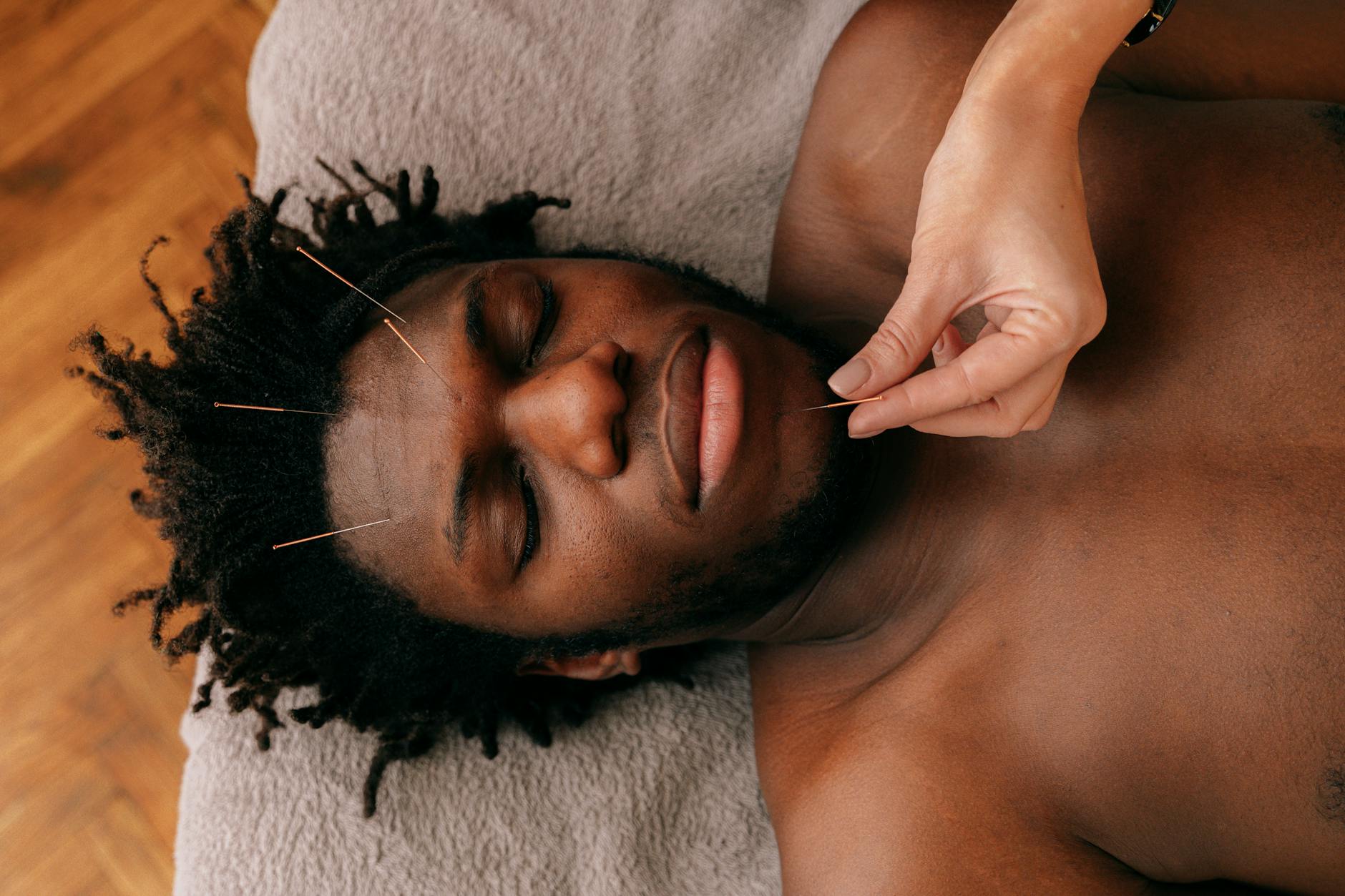 #40 Acupuncture for Depression and Panic Disorder Amsterdam