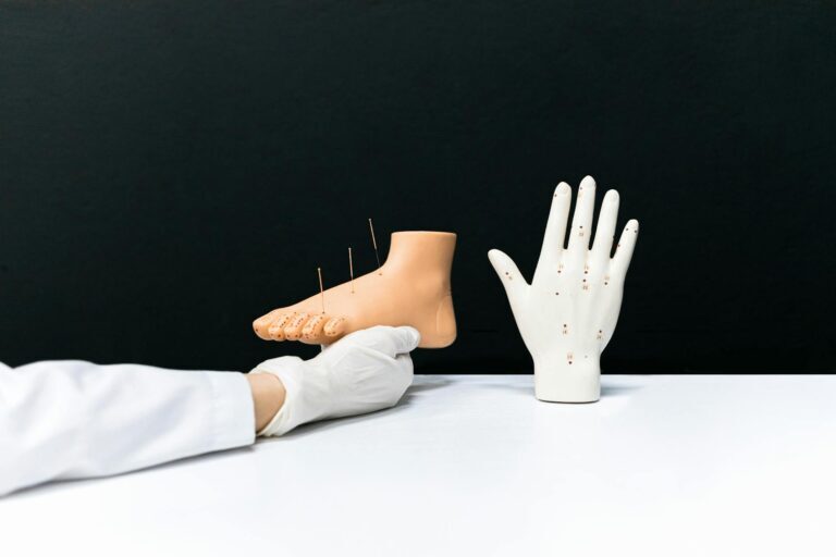 Acupuncture treatment calming the nervous system at AlterPhysio Amsterdam