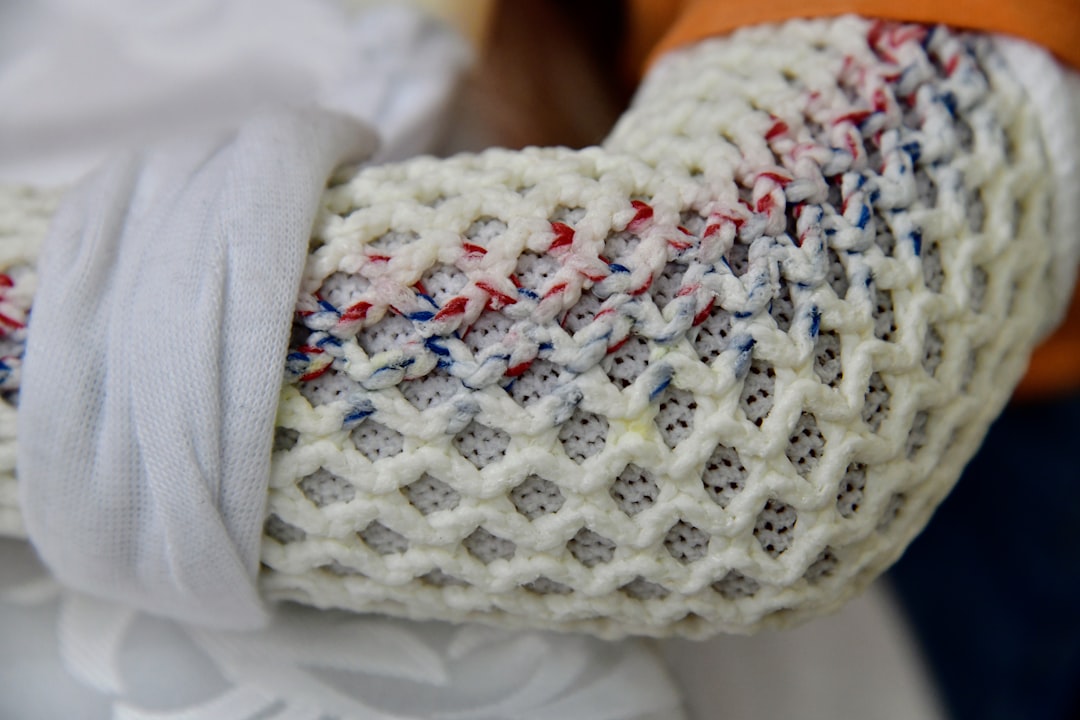 Hand and elbow pain physiotherapy Amsterdam