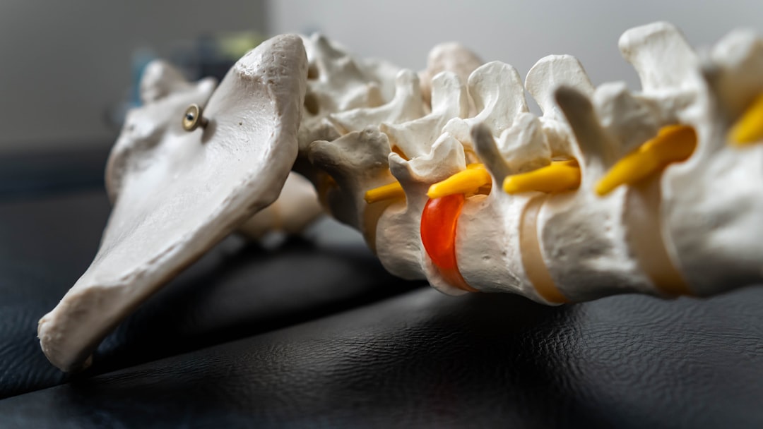 #16 Lower Back Pain Physiotherapy Amsterdam | Expert Guide | Alter Physio